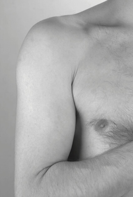 Spalla addotta e intraruotata