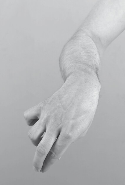 Sintomatologia spastica – Avambraccio intraruotato