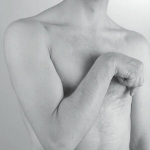 Sintomatologia spastica - Gomito in flessione