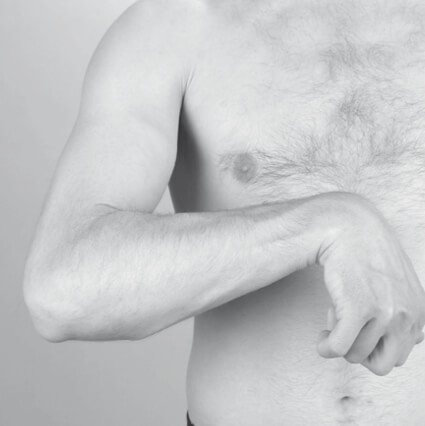 Sintomatologia spastica della mano - Polso in flessione