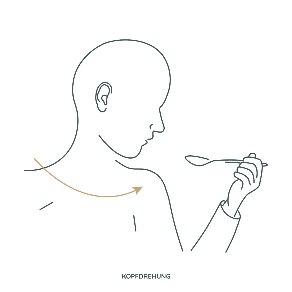 Schlucktraining bei Sialorrhoe: Kopfwendung zur Seite beim Schlucken als Technik zur Vermeidung von Aspiration