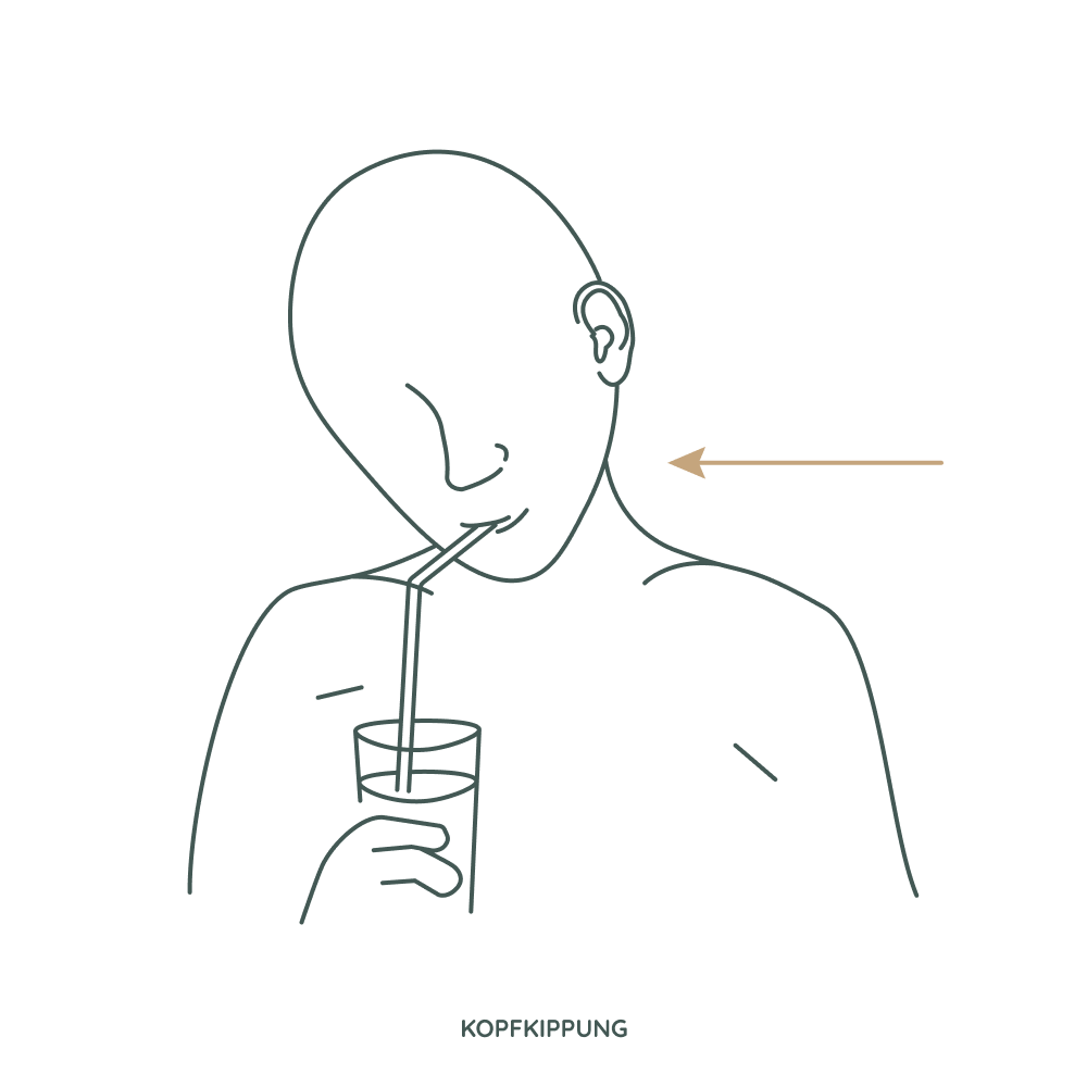 Sialorrhoe-Schlucktherapie: Trinken mit gebeugtem Kopf zur Verbesserung des Schluckakts bei Schluckstörungen