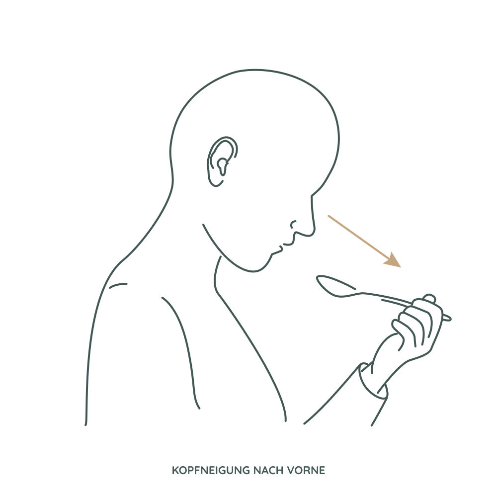 Schluckübung bei Sialorrhoe: Kopfneigung nach vorn beim Löffeln zur besseren Kontrolle beim Schlucken